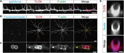 Proteomic Analysis of Dendritic Filopodia-Rich Fraction Isolated by Telencephalin and Vitronectin Interaction